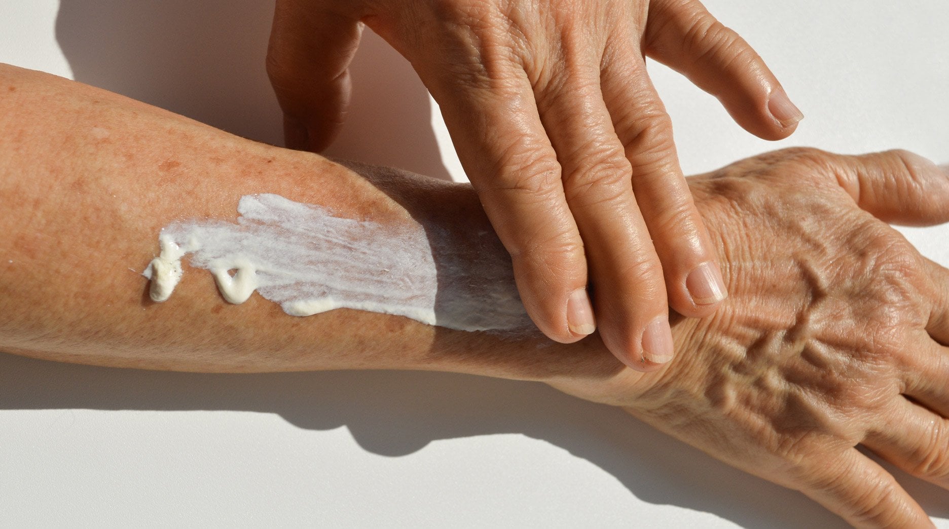 A hand applies a generous amount of white cream to another hand, highlighting the importance of moisturizing to reduce the appearance of dark spots.